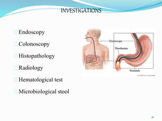 INVESTIGATIONS
Endoscopy
Colonoscopy
Histopathology
Radiology
Hematological test
Microbiological stool
36
 