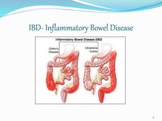 IBD- Inflammatory Bowel Disease
4
 