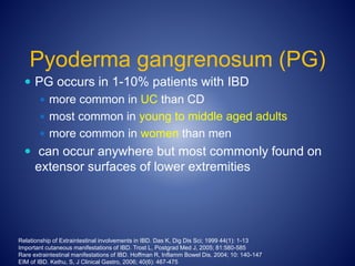 IBD | PPTX