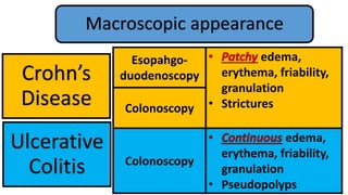 Crohn’s
Disease
Ulcerative
Colitis
Esopahgo-
duodenoscopy
edema,
erythema, friability,
granulation
• StricturesColonoscopy
Colonoscopy
edema,
erythema, friability,
granulation
• Pseudopolyps
Macroscopic appearance
 