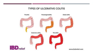 CLINICAL FEATURES OF CROHN’S DISEASE:
 similar to UC, but rectal sparing & presence of perianal dis. in CD.
 Many pts ha...