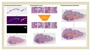 IBD-AI JC AI in pathology for determining inflammatory bowel disease | PPTX