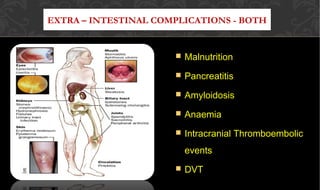 EXTRA – INTESTINAL COMPLICATIONS - BOTH
 MalnutritionMalnutrition
 PancreatitisPancreatitis
 AmyloidosisAmyloidosis
 AnaemiaAnaemia
 Intracranial ThromboembolicIntracranial Thromboembolic
eventsevents
 DVTDVT
 