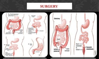 SURGERY
 