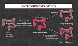 PATHOGENESIS OF IBD
Normal
Gut
Tolerance-
controlled
inflammation
Environmental
trigger
(Infection, NSAID, other)
Acute Injury
Complete Healing
Chronic Inflammation
Genetically
Susceptible
Host
Acute Inflammation
↓ Immunoregulation,
failure of repair or
bacterial clearance
Tolerance
 