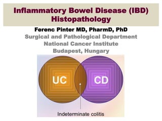 Inflammatory Bowel Disease (IBD)
Histopathology
Ferenc Pinter MD, PharmD, PhD
Surgical and Pathological Department
National Cancer Institute
Budapest, Hungary
 
