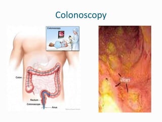 ibd-presentation-150417082301-conversion-gate02.pptx