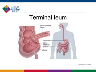 Terminal Ieum
University of Rochester
 