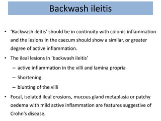Backwash ileitis
• ‘Backwash ileitis’ should be in continuity with colonic inflammation
and the lesions in the caecum should show a similar, or greater
degree of active inflammation.
• The ileal lesions in ‘backwash ileitis’
– active inflammation in the villi and lamina propria
– Shortening
– blunting of the villi
• Focal, isolated ileal erosions, mucous gland metaplasia or patchy
oedema with mild active inflammation are features suggestive of
Crohn's disease.
 