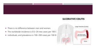  There is no difference between men and women.
 The worldwide incidence is 0.5~24 new cases per 100 000
 individuals, and prevalence is 100~200 cases per 100 000.
 