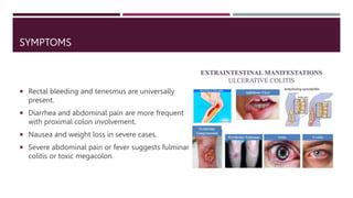 SYMPTOMS
 Rectal bleeding and tenesmus are universally
present.
 Diarrhea and abdominal pain are more frequent
with proximal colon involvement.
 Nausea and weight loss in severe cases.
 Severe abdominal pain or fever suggests fulminant
colitis or toxic megacolon.
 