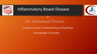 Dr/ Mohammed Hussien
Assistant Lecturer of Gastroentrology & Hepatology
Kafrelsheikh University
Inflammatory Bowel Disease
BY
 