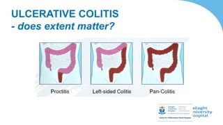 ULCERATIVE COLITIS
- does extent matter?
 