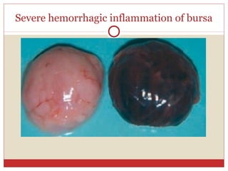 Severe hemorrhagic inflammation of bursa
 