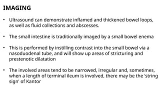 Akntor String. Sign Inflammatory bowel disease investigation and treatmentt.pptx