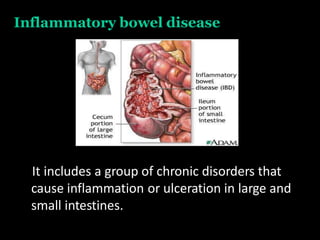 Inflammatory bowel disease
It includes a group of chronic disorders that
cause inflammation or ulceration in large and
small intestines.
 