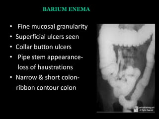 BARIUM ENEMA
• Fine mucosal granularity
• Superficial ulcers seen
• Collar button ulcers
• Pipe stem appearance-
loss of haustrations
• Narrow & short colon-
ribbon contour colon
 