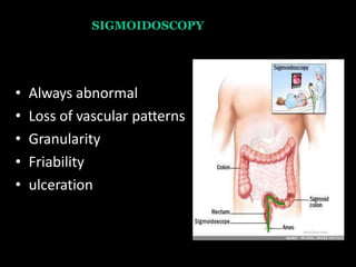SIGMOIDOSCOPY
• Always abnormal
• Loss of vascular patterns
• Granularity
• Friability
• ulceration
 