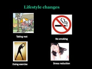 Lifestyle changes
 
