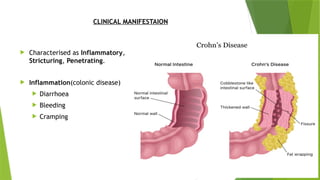 IBD_Presentation_Academic_Professional.pptx