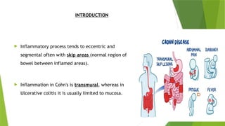 Cohn Process IBD_Presentation_Academic_Professional.pptx