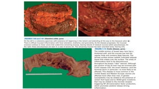 IBD PRESENTATION INCLUDING CROHNS AND ULCERATIVE COLITIS.pptx
