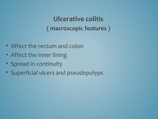 Ulcerative colitis
( macroscopic features )
• Affect the rectum and colon
• Affect the inner lining
• Spread in continuity
• Superficial ulcers and pseudopolyps
 