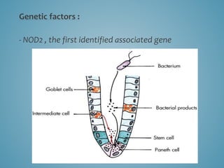 Genetic factors :
- NOD2 , the first identified associated gene
 