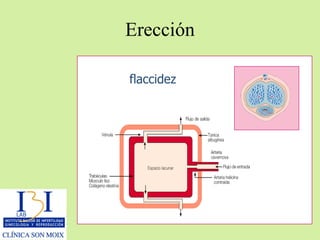 Erección flaccidez 