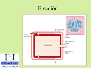 Erección 