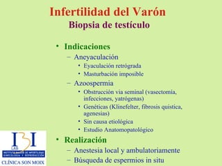 Infertilidad del Varón  Biopsia de testículo Indicaciones Aneyaculación Eyaculación retrógrada Masturbación imposible Azoospermia Obstrucción via seminal (vasectomía, infecciones, yatrógenas) Genéticas (Klinefelter, fibrosis quistica, agenesias) Sin causa etiológica Estudio Anatomopatológico Realización Anestesia local y ambulatoriamente Búsqueda de espermios in situ 