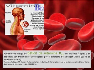 Aumento del riesgo de déficit de vitamina B12 en ancianos frágiles y en 
pacientes con tratamientos prolongados por el síndrome de Zollinger-Ellison [grado de 
recomendación B]. 
Thomson A, Sauve M, Kassam N, Kamitakahara H. Safety of the long-term use of proton pump inhibitors. World J 
Gastroenterol. 2010 May 21;16(19):2323-30. 
 