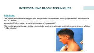 upper limb block and perineural catherers,nerve injury protocol | PDF
