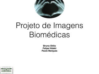 Projeto de Imagens
Biomédicas
Bruno Otilio
Felipe Hideki
Paulo Marques
 