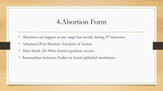 4.Abortion Form
• Abortion can happen at any stage but mostly during 3rd trimester.
• Advanced Post-Mortem Autolysis of foetus.
• After death ,24-36hrs foetal expulsion occurs.
• Intranuclear inclusion bodies in foetal epithelial membrane.
 