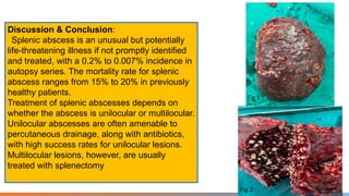 Splenic Micro-Abscesses: Rare Critical Tuberculosis Complication in HIV ...