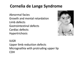 Cornelia de Lange Syndrome
Abnormal facies
Growth and mental retardation
Limb defects
Gastrointestinal defects
Cardiac defects
Hypertrichosis
IUGR
Upper limb reduction defects
Micrognathia with protruding upper lip
CDH
 