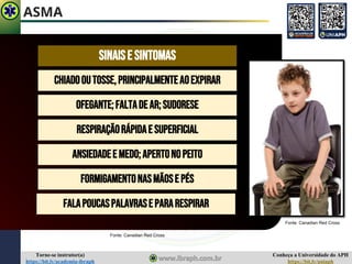 Conheça a Universidade do APH
https://bit.ly/uniaph
Torne-se instrutor(a)
https://bit.ly/academia-ibraph
ASMA
SINAISE SINTOMAS
OFEGANTE;FALTADEAR;SUDORESE
CHIADOOUTOSSE,PRINCIPALMENTEAOEXPIRAR
RESPIRAÇÃORÁPIDAE SUPERFICIAL
ANSIEDADEE MEDO;APERTONOPEITO
FORMIGAMENTONASMÃOSE PÉS
FALAPOUCASPALAVRASE PARARESPIRAR
Fonte: Canadian Red Cross
Fonte: Canadian Red Cross
 