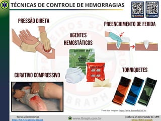 Conheça a Universidade do APH
https://bit.ly/uniaph
Torne-se instrutor(a)
https://bit.ly/academia-ibraph
TÉCNICAS DE CONTROLE DE HEMORRAGIAS
TORNIQUETES
PRESSÃO direta
PREENCHIMENTO DE FERIDA
Fonte da Imagem: IBRAPH Fonte da Imagem: IBRAPH
Fonte da Imagem: IBRAPH
CURATIVO COMPRESSIVO
Fonte das Imagens: https://www.desmodus.ind.br/
AGENTES
HEMOSTÁTICOS
 