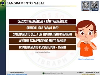 Conheça a Universidade do APH
https://bit.ly/uniaph
Torne-se instrutor(a)
https://bit.ly/academia-ibraph
SANGRAMENTO NASAL
CAUSASTRAUMÁTICASXNÃOTRAUMÁTICAS
QUANDOLIGARPARAO192?
SANGRAMENTOSEC.AUMTRAUMATISMOCRANIANO
AVÍTIMAESTÁPERDENDOMUITOSANGUE
OSANGRAMENTOPERSISTEPOR> 15MIN
https://www.freepik.com/
Fonte: Canadian Red Cross
 
