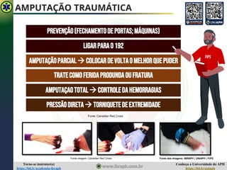 Conheça a Universidade do APH
https://bit.ly/uniaph
Torne-se instrutor(a)
https://bit.ly/academia-ibraph
AMPUTAÇÃO TRAUMÁTICA
PREVENÇÃO(FECHAMENTODEPORTAS;MÁQUINAS)
Fonte: Canadian Red Cross
LIGARPARAO192
AMPUTAÇÃOPARCIAL→ COLOCARDEVOLTAOMELHORQUEPUDER
TRATECOMOFERIDAPRODUNDAOUFRATURA
AMPUTAÇAOTOTAL→ CONTROLEDAHEMORRAGIAS
PRESSÃODIRETA→ TORNIQUETEDEEXTREMIDADE
Fonte imagem: Canadian Red Cross Fonte das imagens: IBRAPH | UNiAPH | FiPS
FIPS
 