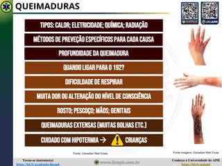 Conheça a Universidade do APH
https://bit.ly/uniaph
Torne-se instrutor(a)
https://bit.ly/academia-ibraph
QUEIMADURAS
TIPOS:CALOR;ELETRICIDADE;QUÍMICA;RADIAÇÃO
MÉTODOSDEPREVEÇÃOESPECÍFICOSPARACADACAUSA
QUANDOLIGARPARAO192?
DIFICULDADEDE RESPIRAR
MUITADOROUALTERAÇÃODONÍVELDE CONSCIÊNCIA
QUEIMADURASEXTENSAS(MUITASBOLHASETC.)
ROSTO;PESCOÇO;MÃOS;GENITAIS
CUIDADOCOMHIPOTERMIA→ CRIANÇAS
PROFUNDIDADEDAQUEIMADURA
Fonte imagens: Canadian Red Cross
Fonte: Canadian Red Cross
 