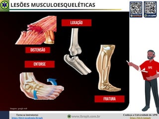 Conheça a Universidade do APH
https://bit.ly/uniaph
Torne-se instrutor(a)
https://bit.ly/academia-ibraph
LESÕES MUSCULOESQUELÉTICAS
Imagens: google web
Fratura
Luxação
Entorse
Distensão
FIPS
 