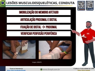 Conheça a Universidade do APH
https://bit.ly/uniaph
Torne-se instrutor(a)
https://bit.ly/academia-ibraph
LESÕES MUSCULOESQUELÉTICAS, CONDUTA
Imagem: IBRAPH
IMOBILIZAÇÃODOMEMBROAFETADO
ARTICULAÇÃOPROXIMALE DISTAL
FIXAÇÃODEDISTAl→ PROXIMAL
VERIFICARPERFUSÃOPERIFÉRICA FIPS
 