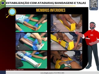 www.ibraph.com.br | (71) 9 9912-1001
ESTABILIZAÇÃO COM ATADURAS/BANDAGENS E TALAS
Membros inferiores
Fonte das imagens: IBRAPH
FIPS
 