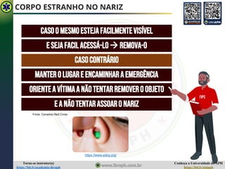Conheça a Universidade do APH
https://bit.ly/uniaph
Torne-se instrutor(a)
https://bit.ly/academia-ibraph
CORPO ESTRANHO NO NARIZ
CASOOMESMOESTEJAFACILMENTEVISÍVEL
E SEJAFACILACESSÁ-LO→ REMOVA-O
CASOCONTRÁRIO
MANTEROLUGARE ENCAMINHARAEMERGÊNCIA
ORIENTEA VÍTIMAANÃOTENTARREMOVEROOBJETO
E ANÃOTENTARASSOARO NARIZ
FIPS
https://www.sidra.org/
Fonte: Canadian Red Cross
 