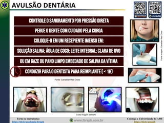 Conheça a Universidade do APH
https://bit.ly/uniaph
Torne-se instrutor(a)
https://bit.ly/academia-ibraph
AVULSÃO DENTÁRIA
CONTROLEO SANGRAMENTOPORPRESSÃODIRETA
Fonte imagem: IBRAPH
PEGUEODENTECOMCUIDADOPELACOROA
COLOQUE-OEMUMRECEPIENTEIMERSOEM:
SOLUÇÃOSALINA;ÁGUADECOCO;LEITEINTEGRAL;CLARADE OVO
OUEMGAZEOUPANOLIMPOEMBEDADODESALIVADAVÍTIMA
CONDUZIRPARAODENTISTAPARAREIMPLANTE(<1H)
Fonte
imagem:
Canadian
Red
Cross
Fonte: Canadian Red Cross
 