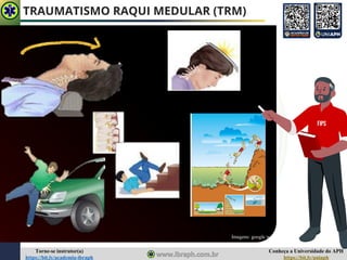 Conheça a Universidade do APH
https://bit.ly/uniaph
Torne-se instrutor(a)
https://bit.ly/academia-ibraph
TRAUMATISMO RAQUI MEDULAR (TRM)
Imagens: google web
FIPS
 