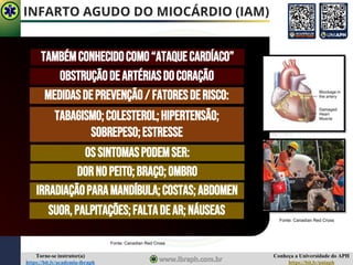 Conheça a Universidade do APH
https://bit.ly/uniaph
Torne-se instrutor(a)
https://bit.ly/academia-ibraph
INFARTO AGUDO DO MIOCÁRDIO (IAM)
TAMBÉMCONHECIDOCOMO“ATAQUECARDÍACO”
OBSTRUÇÃODEARTÉRIASDOCORAÇÃO
OSSINTOMASPODEMSER:
DORNOPEITO;BRAÇO;OMBRO
SUOR,PALPITAÇÕES;FALTADEAR;NÁUSEAS
IRRADIAÇÃOPARAMANDÍBULA;COSTAS;ABDOMEN
MEDIDASDEPREVENÇÃO/ FATORESDERISCO:
TABAGISMO;COLESTEROL;HIPERTENSÃO;
SOBREPESO;ESTRESSE
Fonte: Canadian Red Cross
Fonte: Canadian Red Cross
 