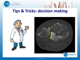 Tips & Tricks: decision making
 